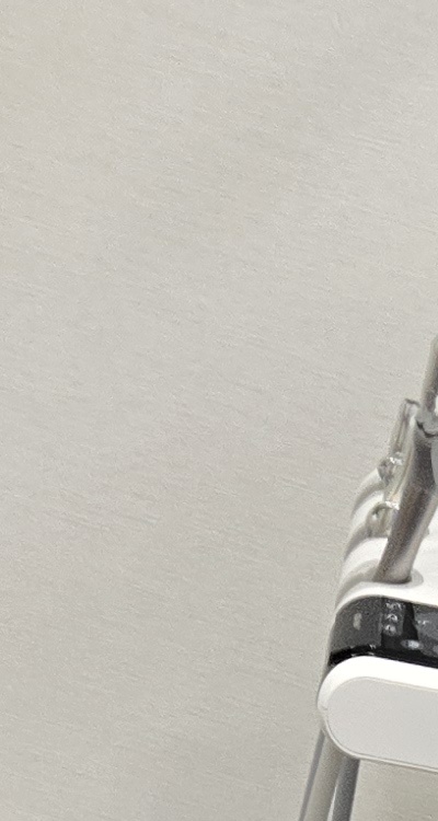 치아 사이 벌어짐 심해지는 이유부터 알아보면 관련 이미지 13