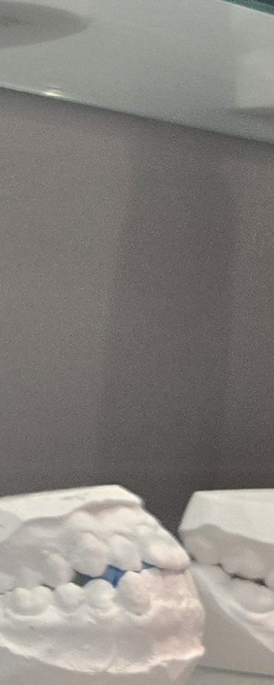 어르신 임플란트 지원 현명하게 활용하려면 관련 이미지 29