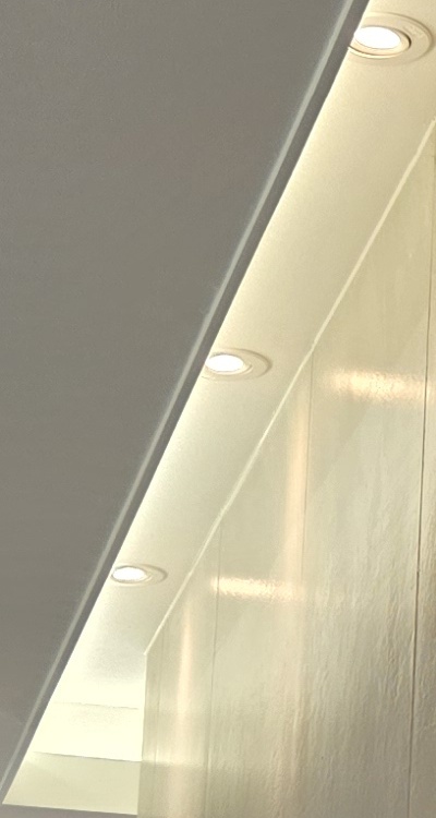 반대교합 치아교정 해결 가능할까 관련 이미지 21