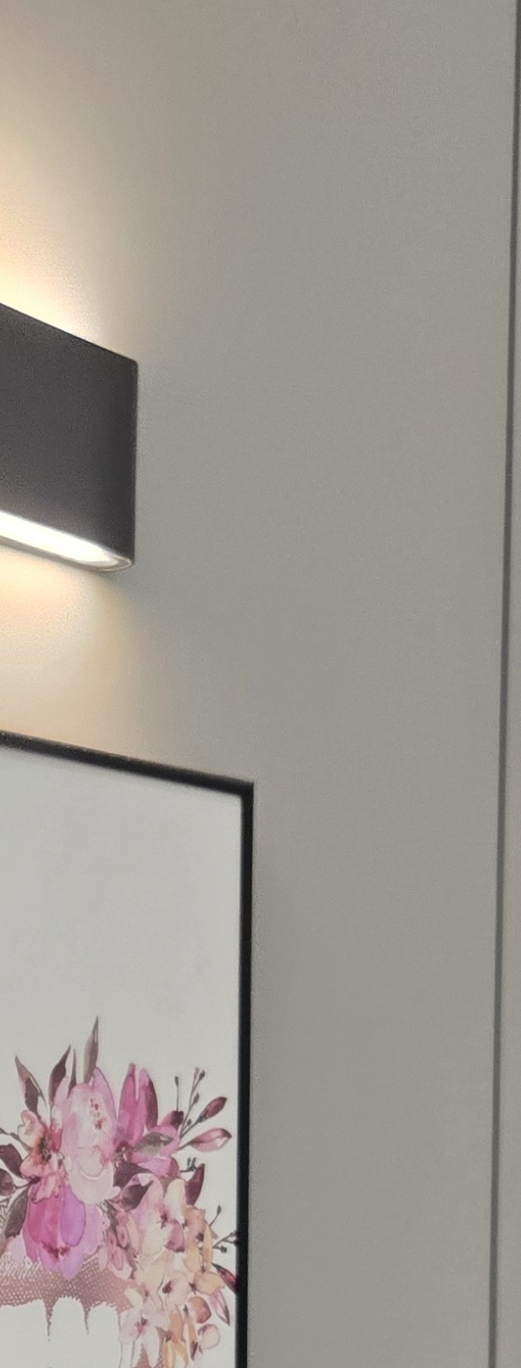 앞니 크라운 교체 깔끔하게 정리하려면 관련 이미지 33