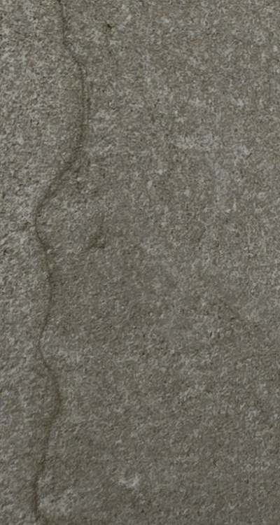 앞니 신경치료 크라운 까지 해야할 상황이라면 관련 이미지 43