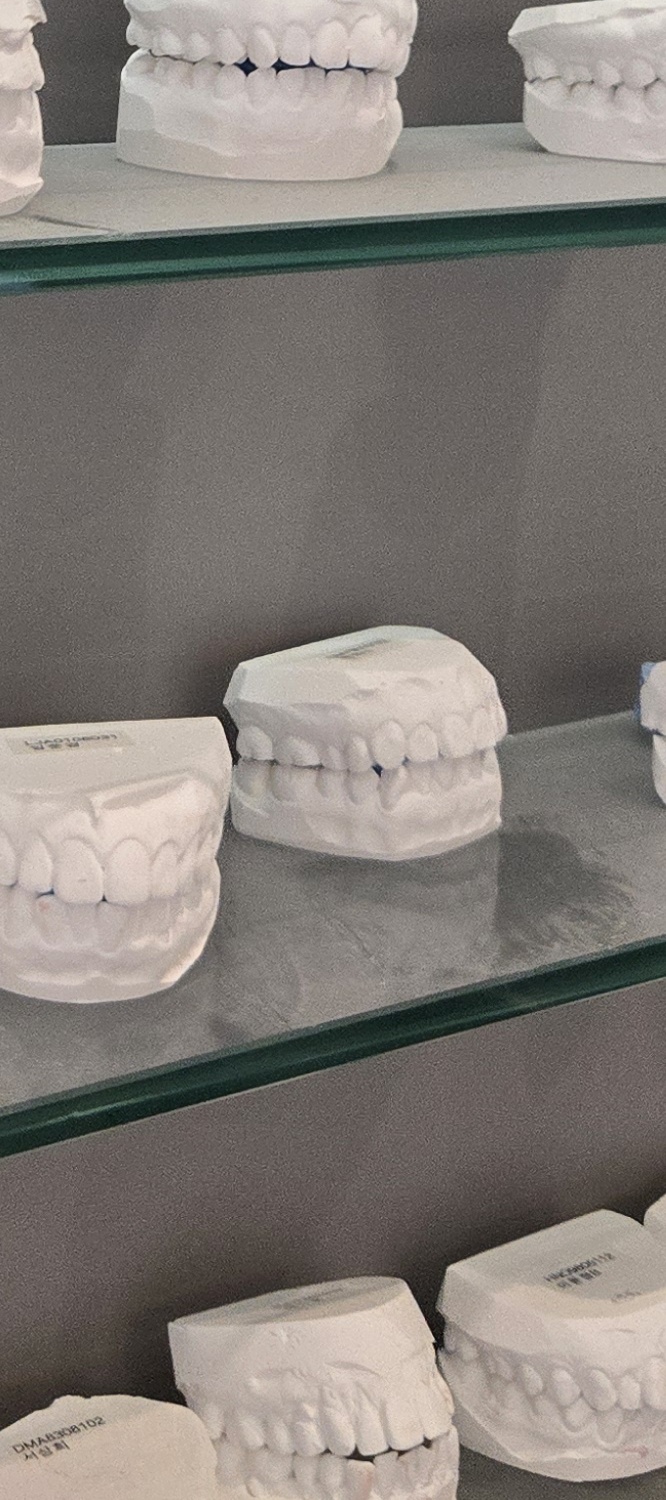 앞니 틀어짐 교정 이렇게 파악하세요 관련 이미지 19