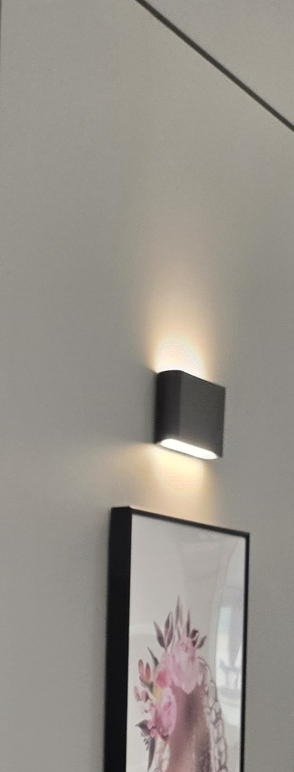 앞니 크라운 교체 깔끔하게 정리하려면 관련 이미지 34