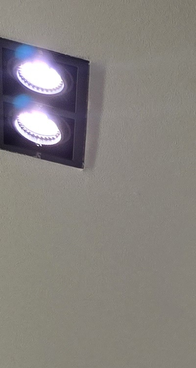 반대교합 치아교정 해결 가능할까 관련 이미지 10