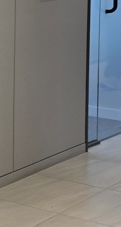 임플란트 뼈이식 안하면 어떤 문제가 있는거죠 관련 이미지 41