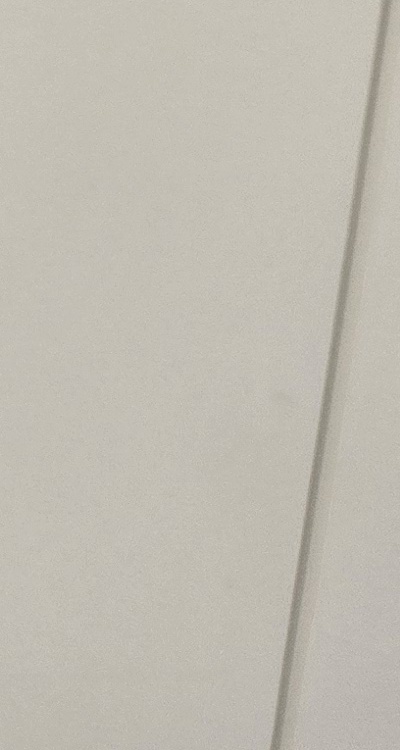 송곳니 크라운 티가 안나게 해결 가능한건가요 관련 이미지 48