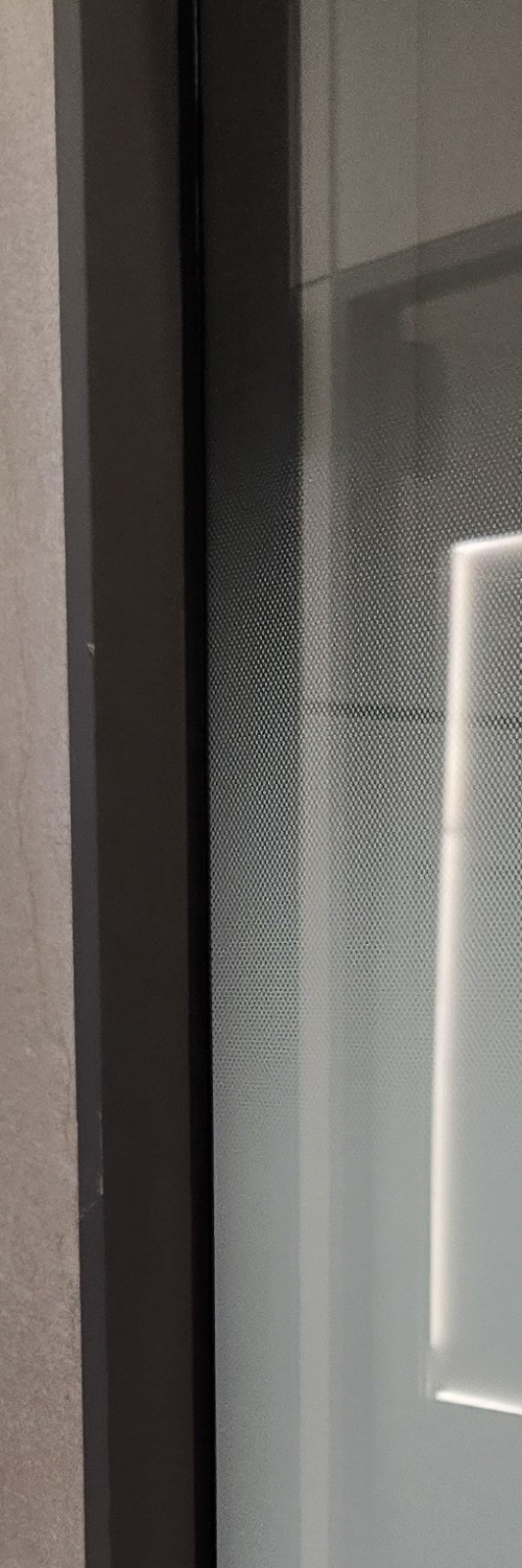 부분매복 사랑니 발치 신중하게 대비하려면 관련 이미지 10