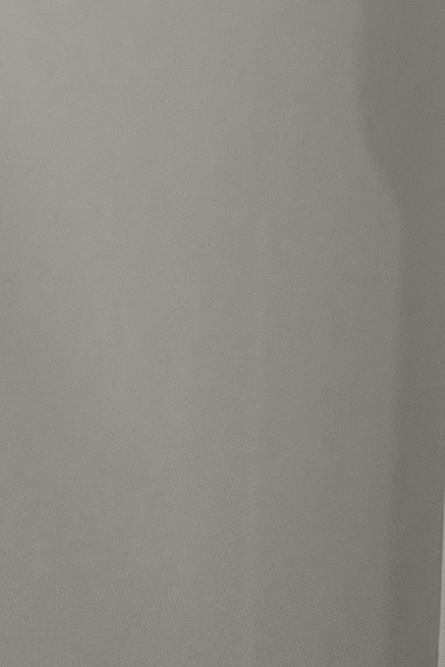 부정교합 교정 안하면 생기는 문제는 뭔가요 관련 이미지 42