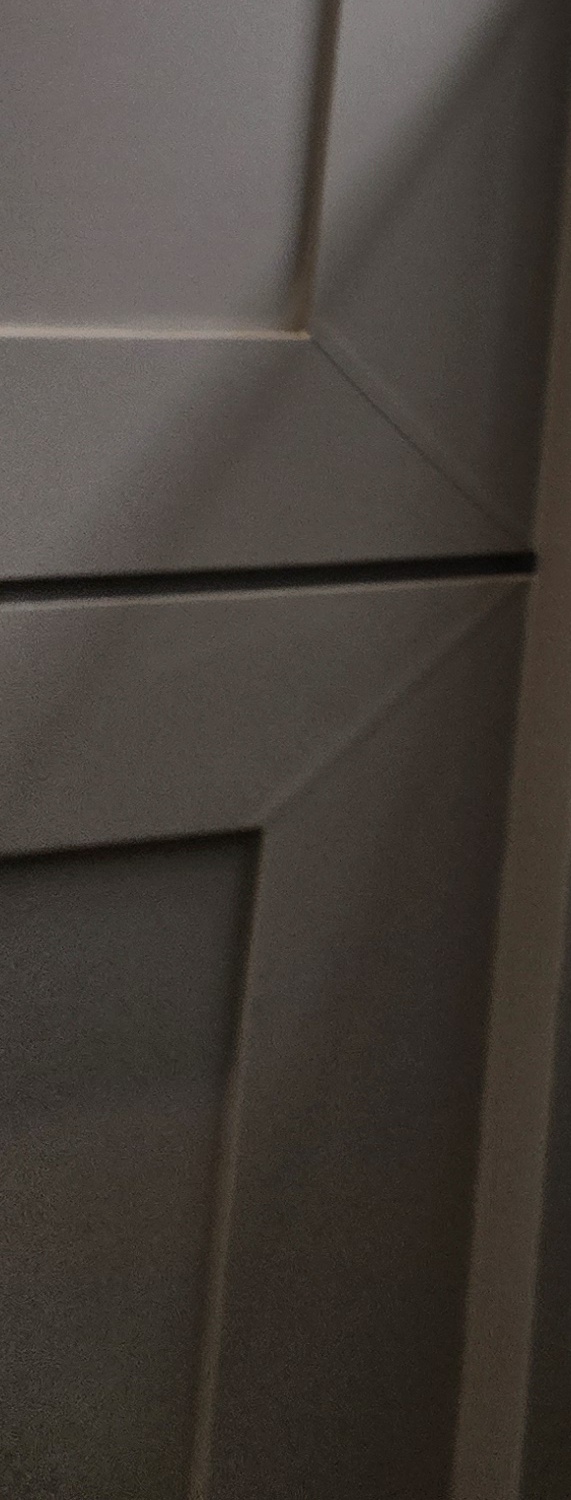 치과 치아미백 효과 어떤식으로 나타날까 관련 이미지 37