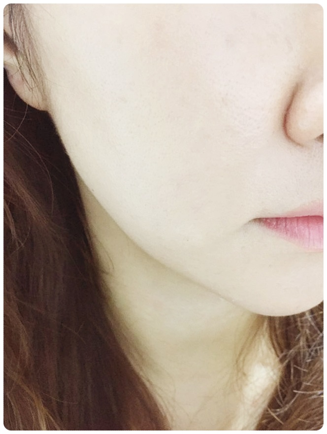 환절기 각질 고민타파! 관련 이미지 8