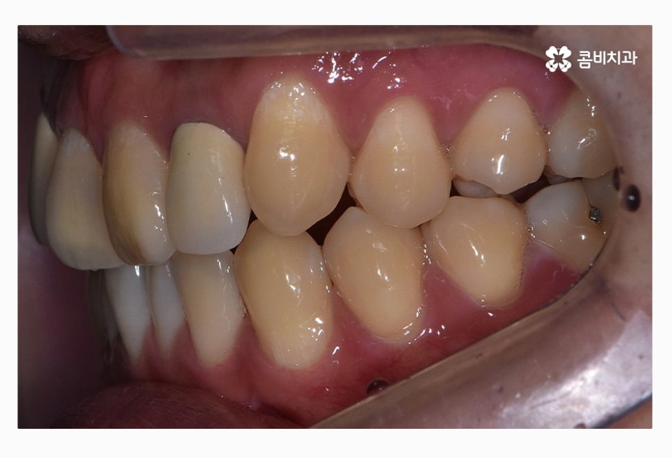 콤비교정 올바르게 판단하려면 관련 이미지 3