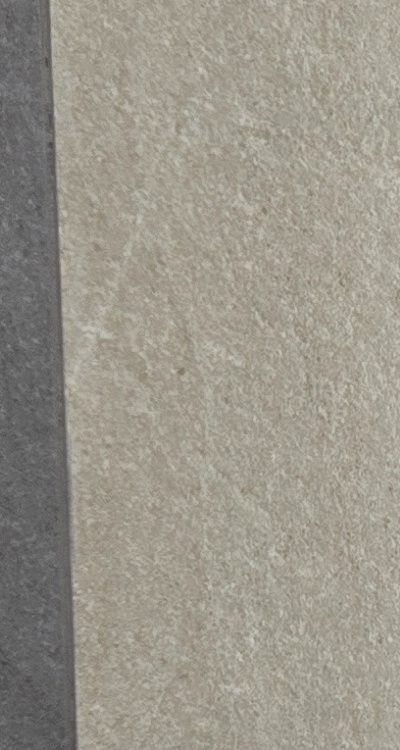 임플란트의 장점 할까 말까 고민이신 분들을 위한 정리 관련 이미지 22