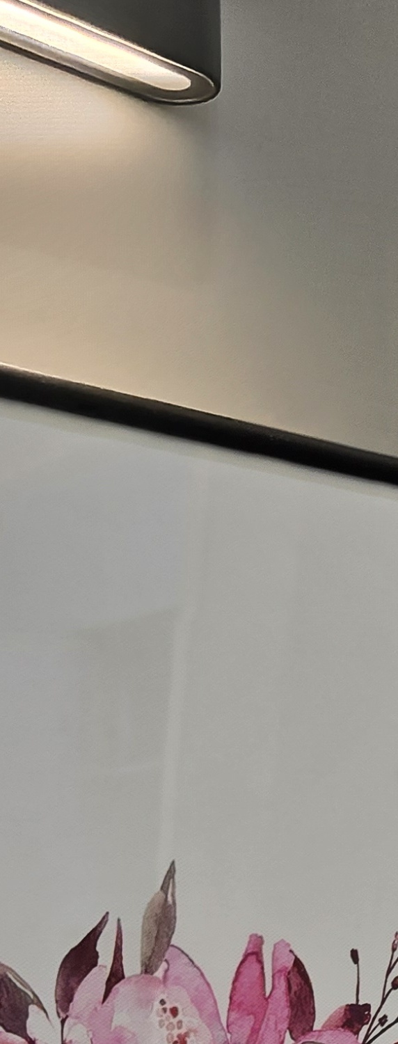 충치 치아 깨짐 시점이 관건이라면 관련 이미지 13