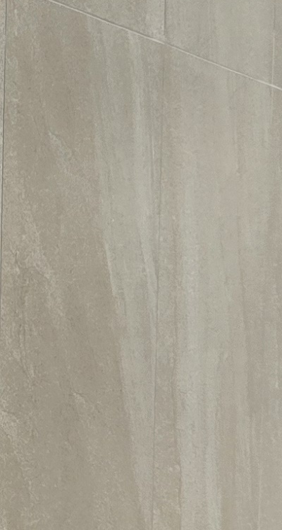 임플란트의 장점 할까 말까 고민이신 분들을 위한 정리 관련 이미지 26