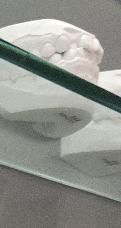 사랑니 주변 잇몸 통증 지금부터가 중요하니까 관련 이미지 18