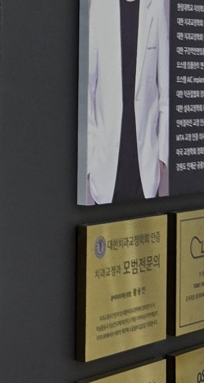 치아 발치 후 임플란트 언제부터 준비할까 관련 이미지 39