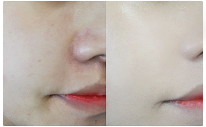 쿠션파운데이션추천 차원이달라 관련 이미지 5