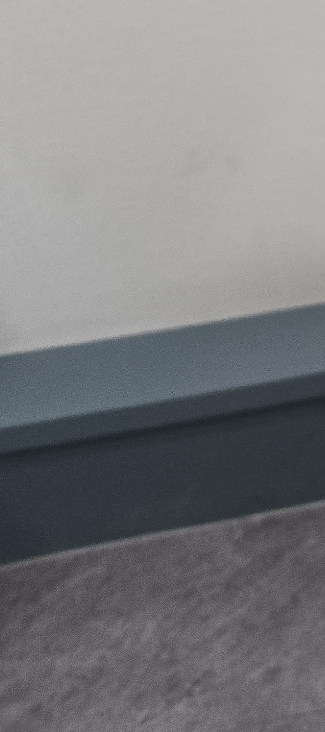 50대 임플란트 치과 지금부터 잘대처하려면 관련 이미지 19