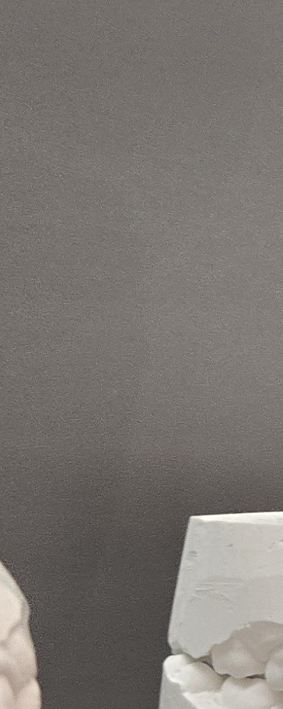 어르신 임플란트 지원 현명하게 활용하려면 관련 이미지 25