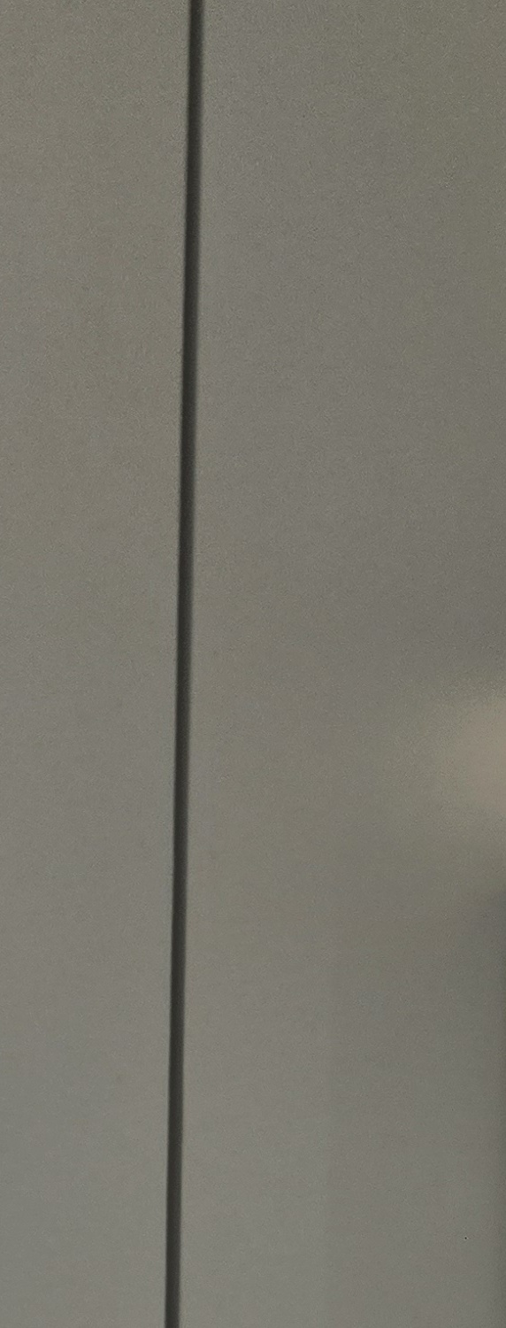 충치 치아 깨짐 시점이 관건이라면 관련 이미지 15