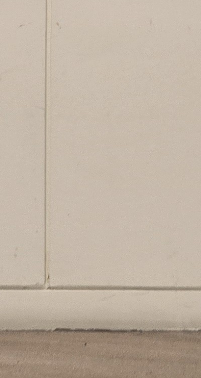 앞니 올세라믹 이건 알고 시작하세요 관련 이미지 44