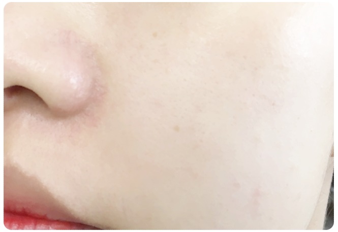 얼굴필링! 가을철얼굴각질제거에는 이게 특효죠 관련 이미지 2