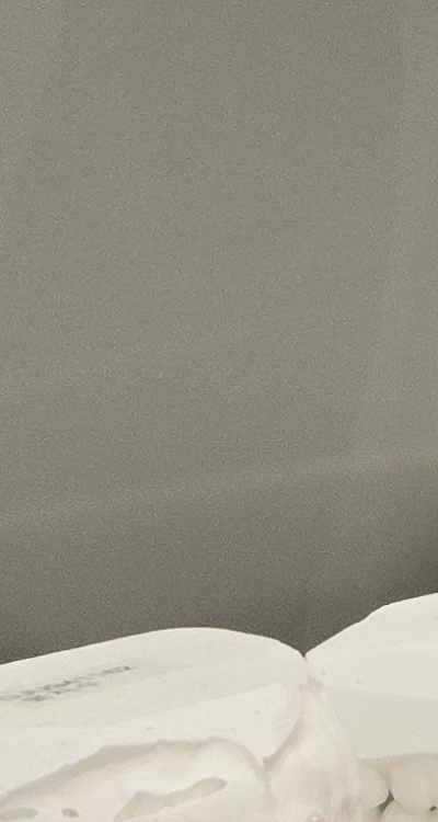 앞니 틀어짐 부분교정 얼마나 걸릴까 관련 이미지 35