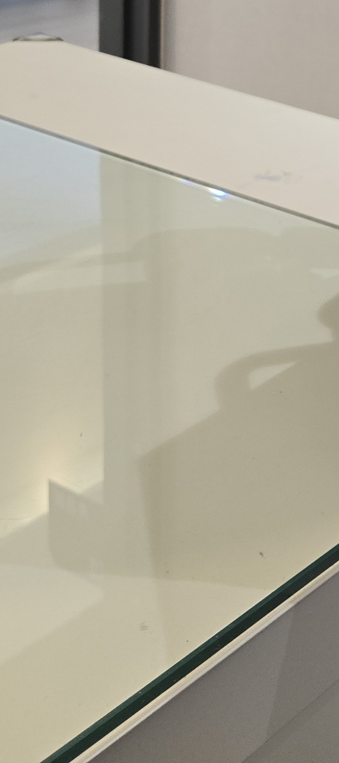 앞니 틀어짐 교정 방법 이럴때는 좀더 간단해요 관련 이미지 16