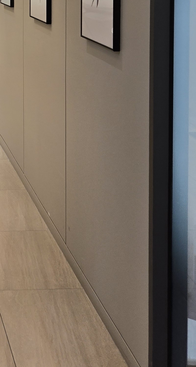 어금니 충치 단계 미리 알아차리려면 관련 이미지 33