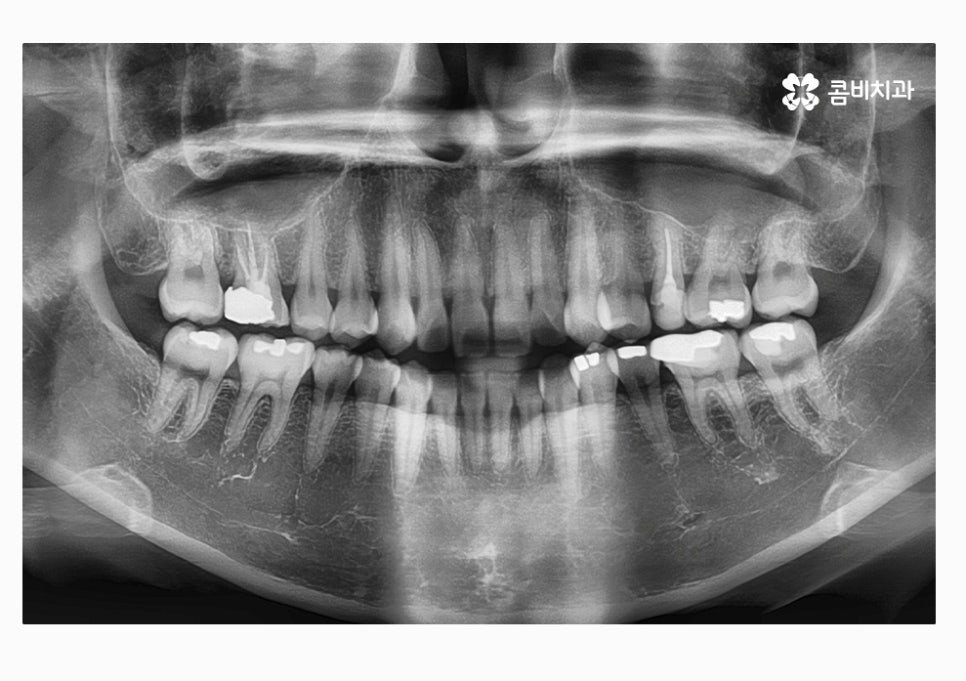 콤비교정 합리적으로 판단하려면 관련 이미지 5