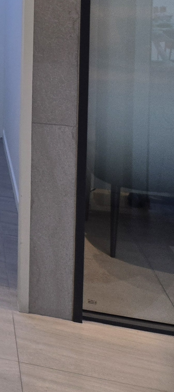 벌어진 앞니 교정 체계적으로 대비하려면 관련 이미지 23