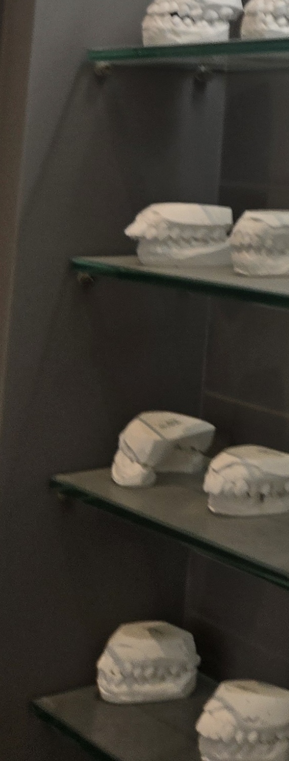 치과 치아미백 효과 어떤식으로 나타날까 관련 이미지 38