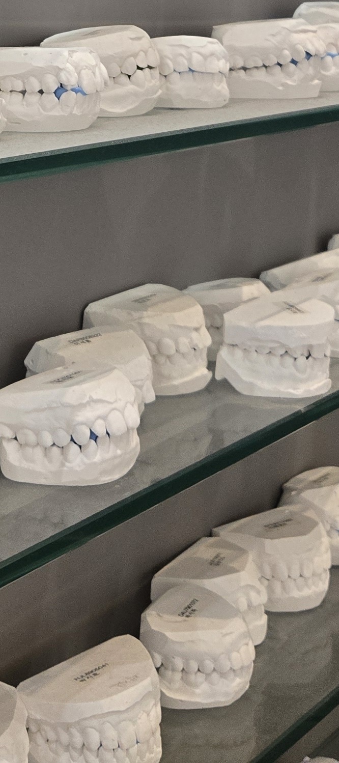돌출 앞니 교정 이렇게 준비하세요 관련 이미지 31