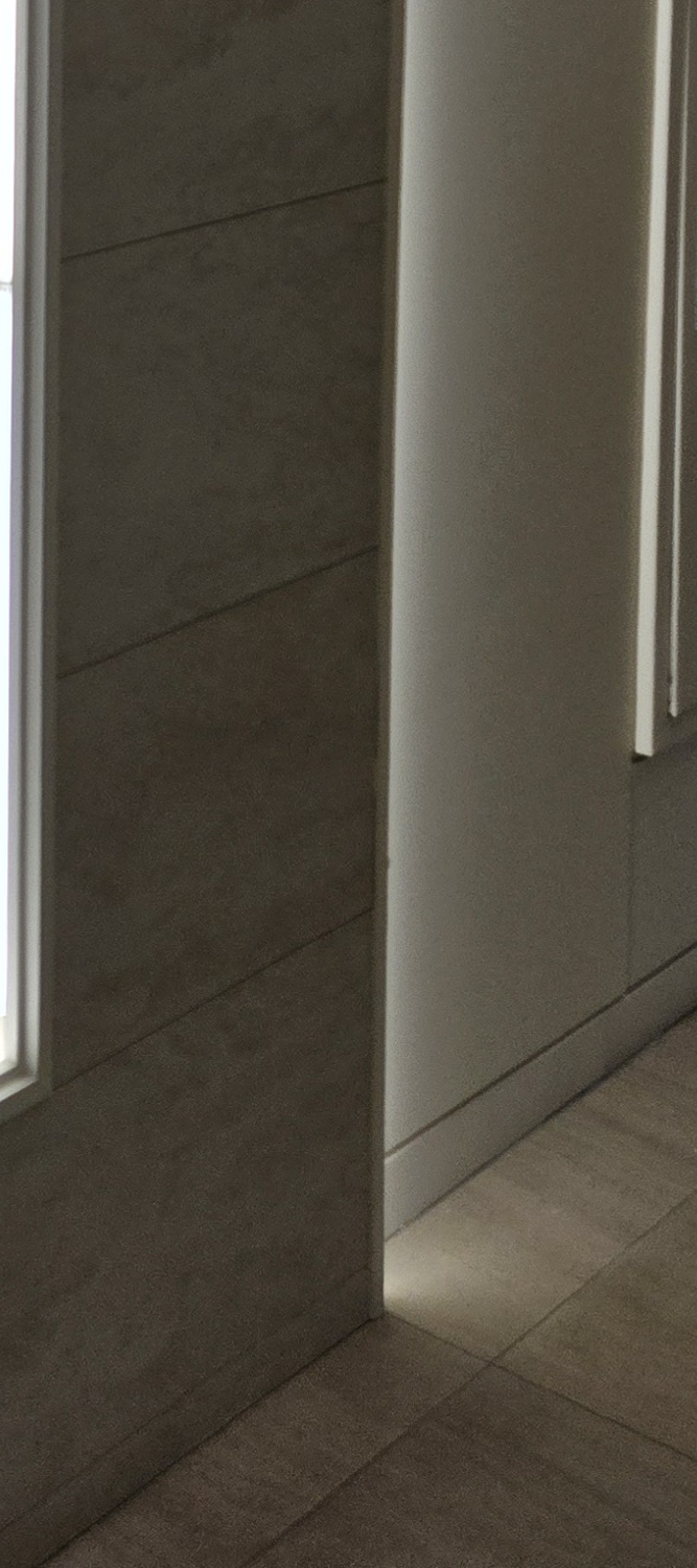 어금니 충치 단계 미리 알아차리려면 관련 이미지 23