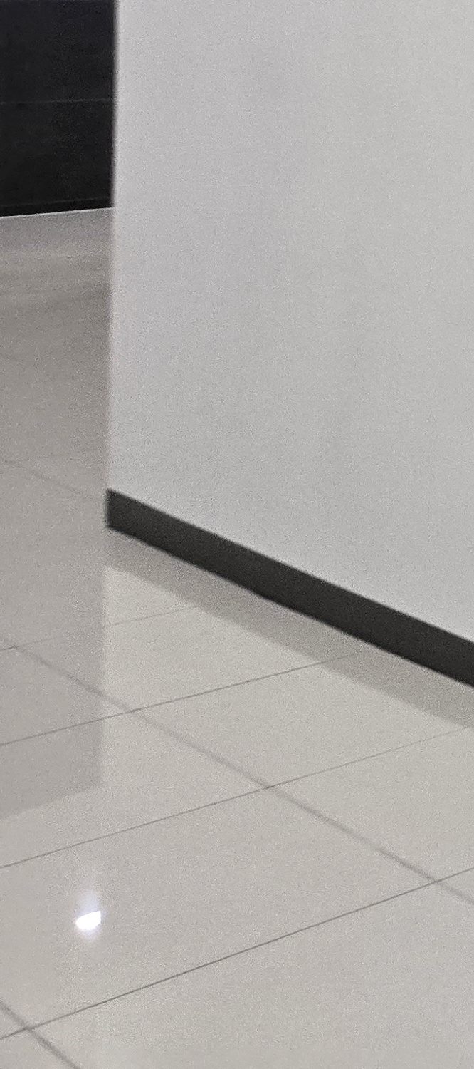 충치 치아 깨짐 시점이 관건이라면 관련 이미지 31