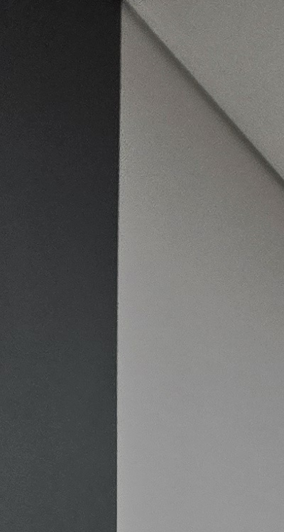 치아 발치 후 임플란트 언제부터 준비할까 관련 이미지 20