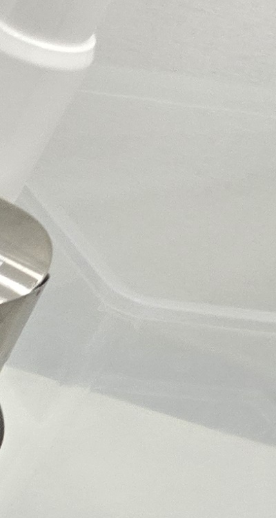 치아 사이 벌어짐 심해지는 이유부터 알아보면 관련 이미지 27