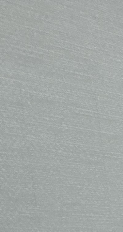 충치 검은점 나타났다면 이렇게 대처해요 관련 이미지 12