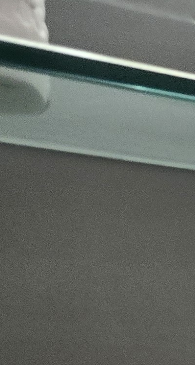 완전매복사랑니 발치 대학병원 꼭 가야하나요 관련 이미지 20