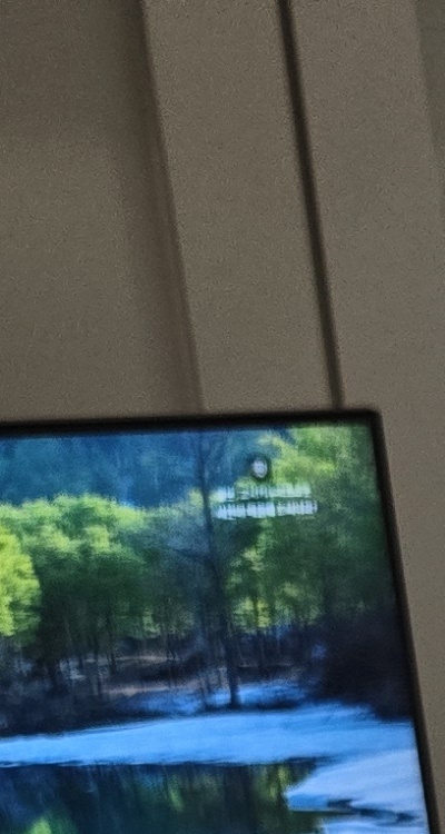 신경치료 아픈가요 망설이시는 분들이라면 관련 이미지 13