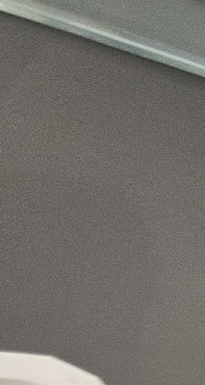 사랑니 주변 잇몸 통증 지금부터가 중요하니까 관련 이미지 14