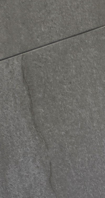 임플란트의 장점 할까 말까 고민이신 분들을 위한 정리 관련 이미지 11