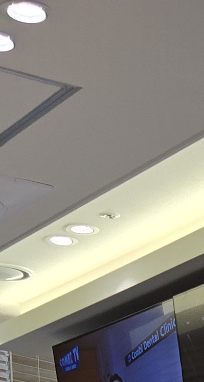 임플란트 뼈이식 안하면 어떤 문제가 있는거죠 관련 이미지 16