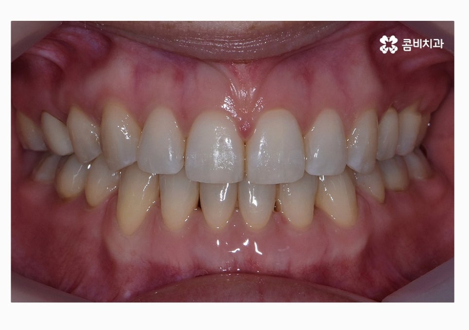 콤비교정 합리적으로 판단하려면 관련 이미지 15