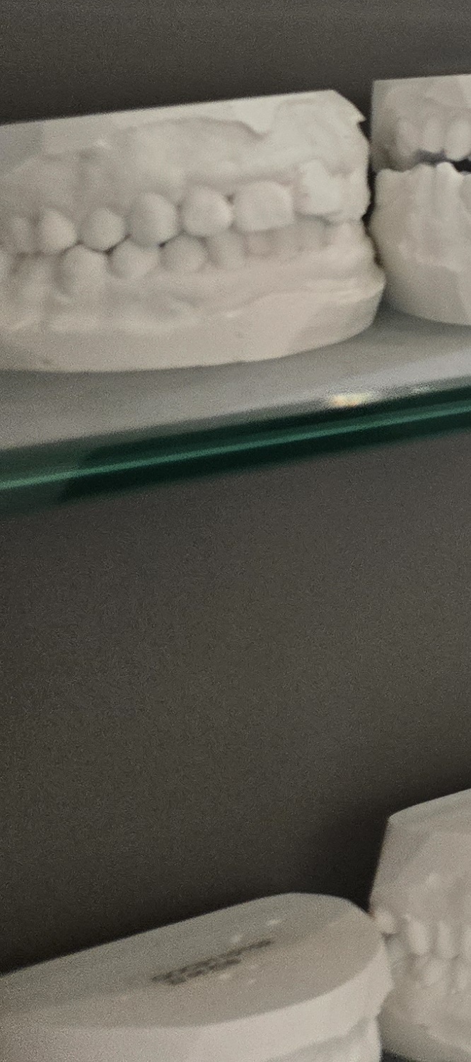 돌출 앞니 교정 이렇게 준비하세요 관련 이미지 28