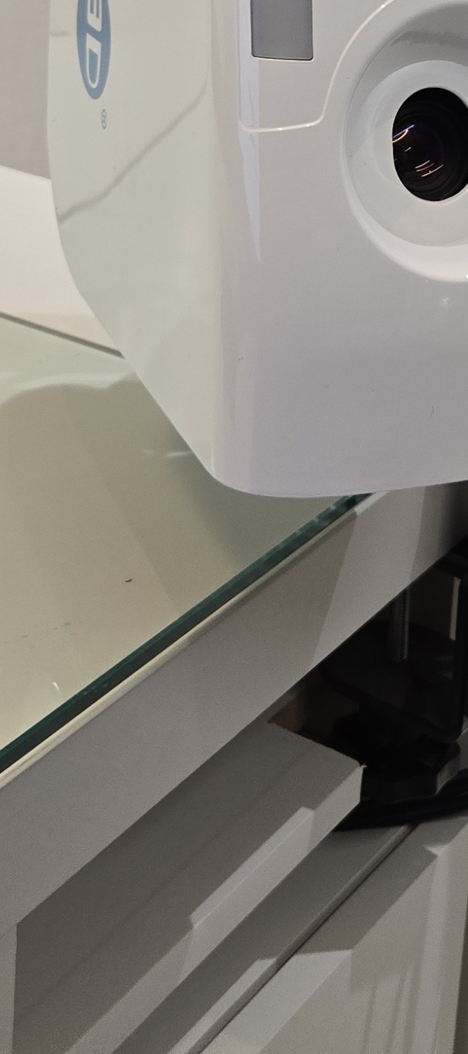 앞니 틀어짐 교정 방법 이럴때는 좀더 간단해요 관련 이미지 17