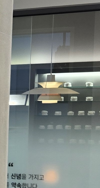 임플란트의 장점 할까 말까 고민이신 분들을 위한 정리 관련 이미지 27