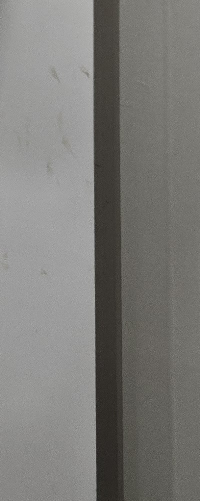 인레이 치료 후 신경치료 이유가 궁금하다면 관련 이미지 39