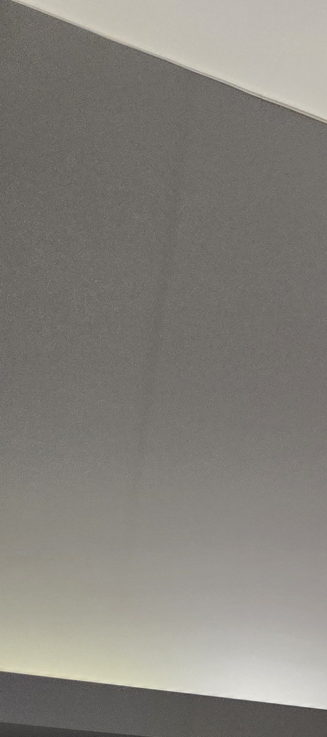 어금니 임플란트 뼈이식 이럴때 해당됩니다 관련 이미지 21