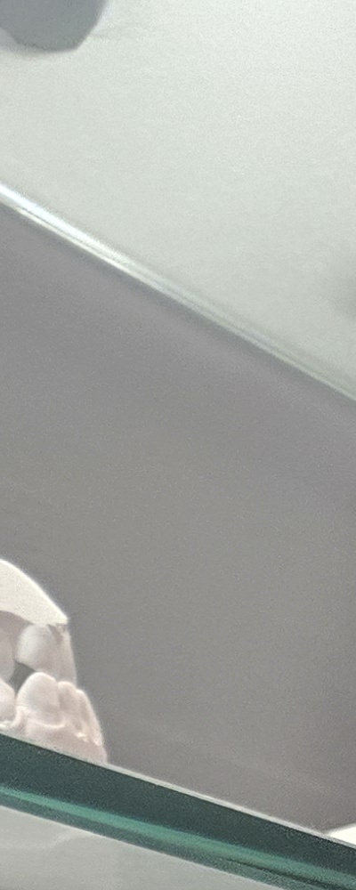 어르신 임플란트 지원 현명하게 활용하려면 관련 이미지 19